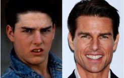 Tom Cruise before & after Tom Cruise before & after